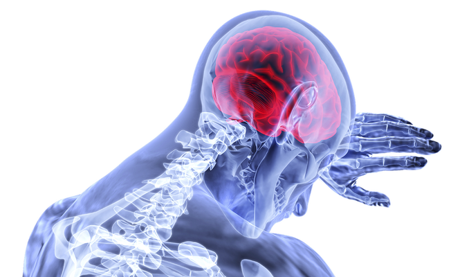 Traumatic Brain Injuries: Understanding the Different Levels of TBI